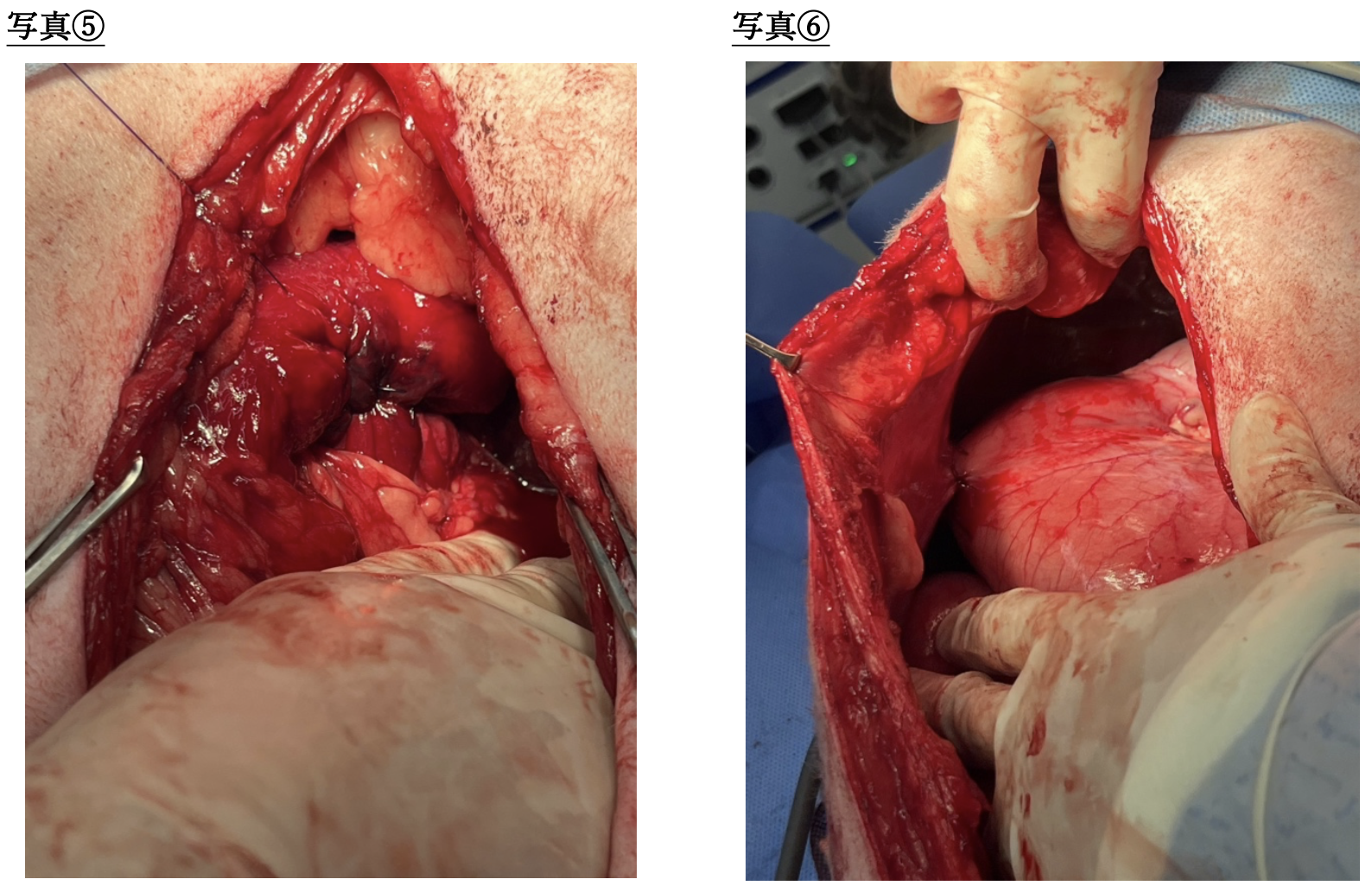 スクリーンショット 2026-03-23 15.43.19