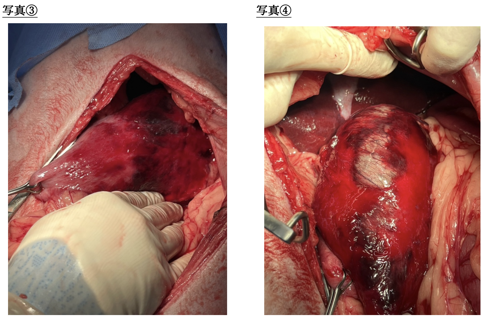 スクリーンショット 2026-03-23 15.43.11
